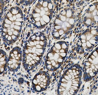 Immunohistochemistry (Formalin/PFA-fixed paraffin-embedded sections) - Anti-PACT (PKR activating protein) / PRKRA antibody [SR4053] (AB326703)