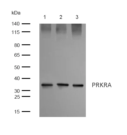 Western blot - Anti-PACT (PKR activating protein) / PRKRA antibody [SR4053] (AB326703)