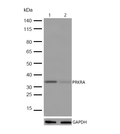 Western blot - Anti-PACT (PKR activating protein) / PRKRA antibody [SR4053] (AB326703)
