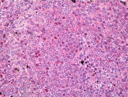 Immunohistochemistry (Formalin/PFA-fixed paraffin-embedded sections) - Anti-PADI1 / PAD1 antibody (AB181762)
