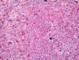 Immunohistochemistry (Formalin/PFA-fixed paraffin-embedded sections) - Anti-PADI1 / PAD1 antibody (AB181762)