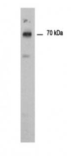 Western blot - Anti-PADI1 / PAD1 antibody (AB181762)