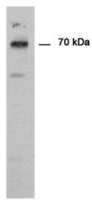 Western blot - Anti-PADI1 / PAD1 antibody (AB181791), expandable thumbnail
