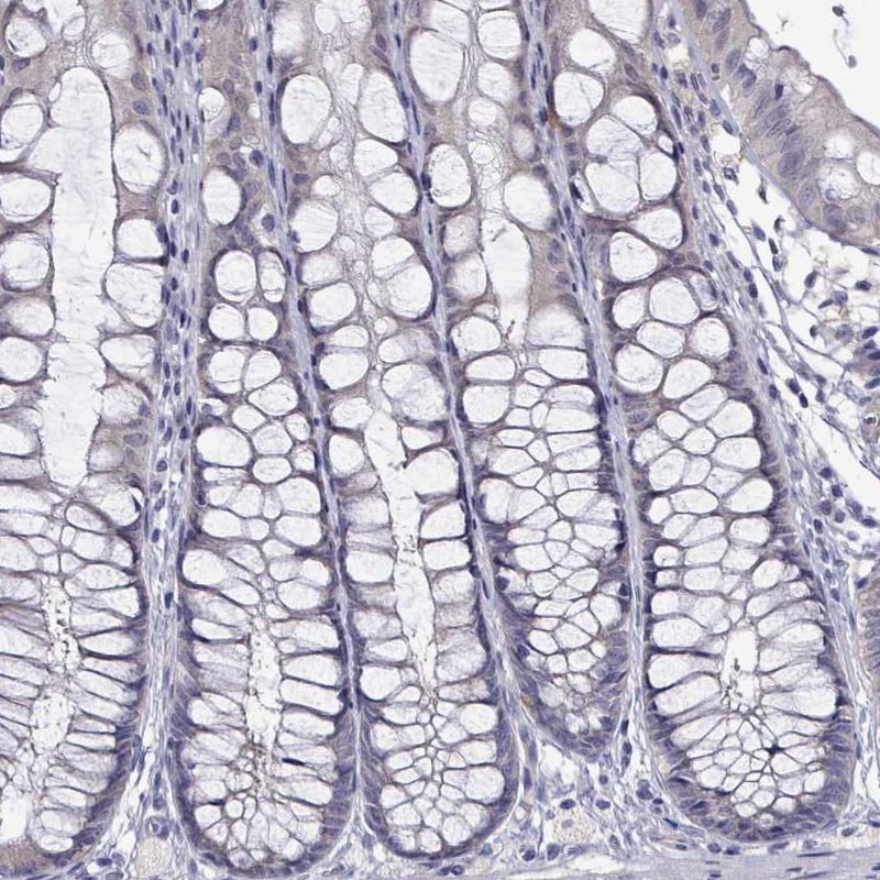 Immunohistochemistry (Formalin/PFA-fixed paraffin-embedded sections) - Anti-PADI1 / PAD1 antibody (AB251967)