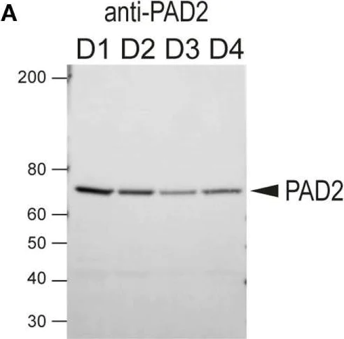 Western blot - Anti-PADI2 / PAD2 antibody (AB16478)