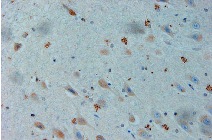 Immunohistochemistry (Formalin/PFA-fixed paraffin-embedded sections) - Anti-PADI2 / PAD2 antibody - C-terminal (AB183194)