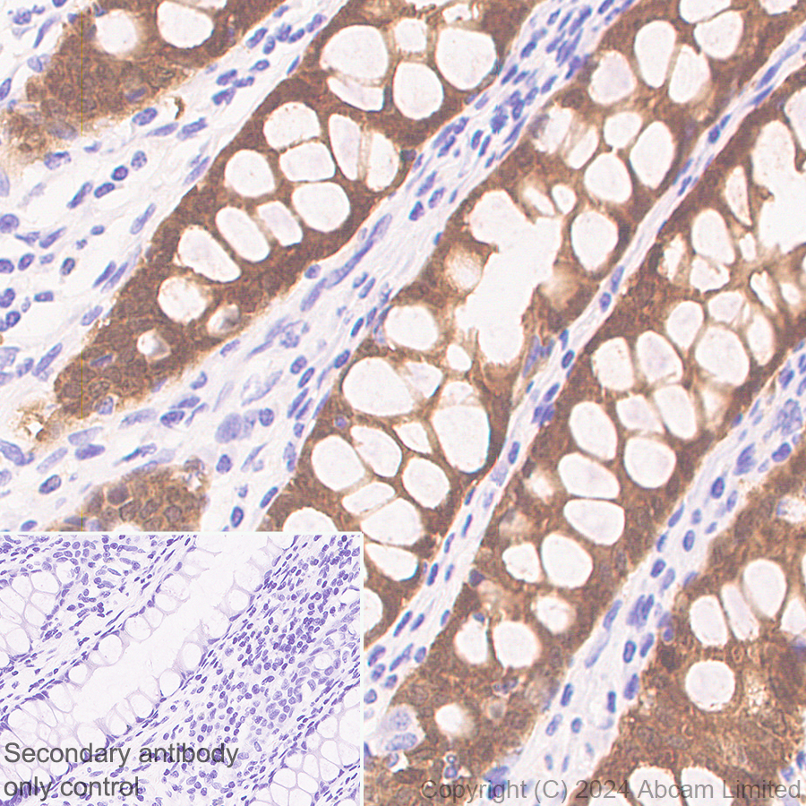 Immunohistochemistry (Formalin/PFA-fixed paraffin-embedded sections) - Anti-PADI2 / PAD2 antibody [EPR26940-85] (ab322197), expandable thumbnail