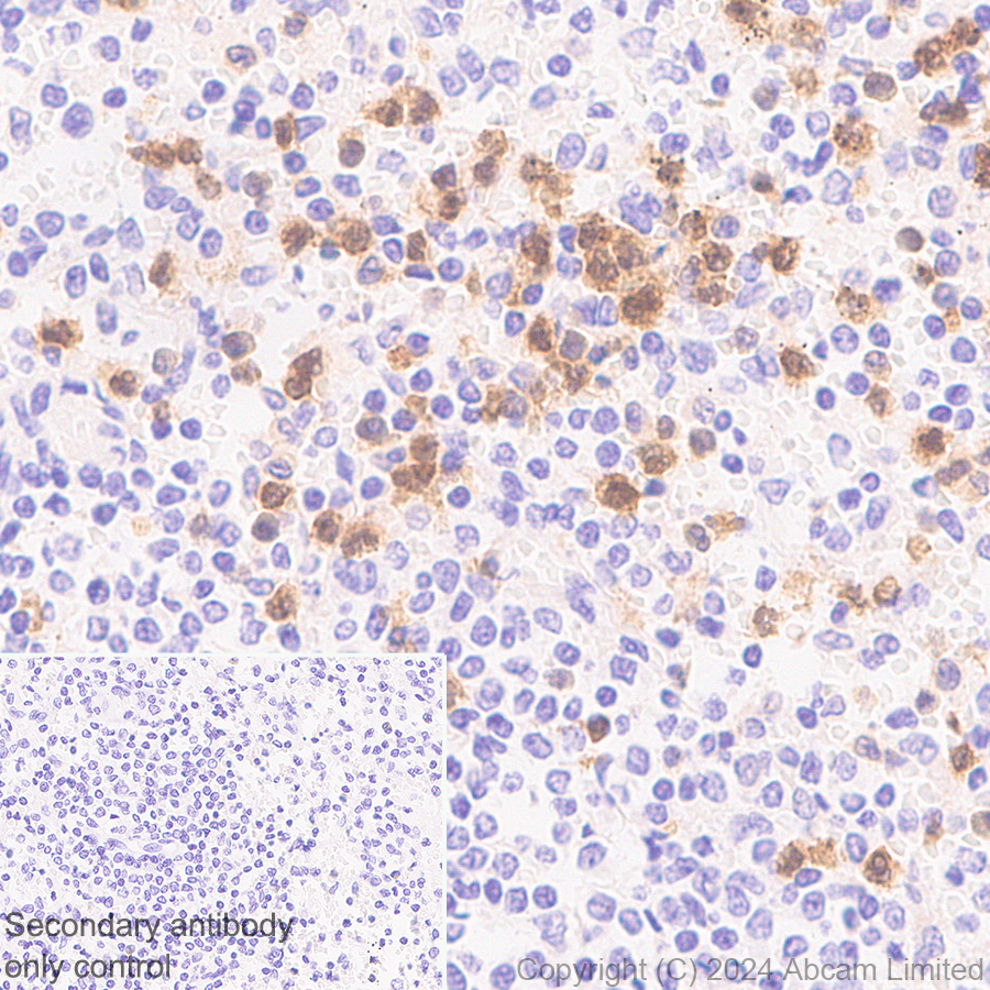 Immunohistochemistry (Formalin/PFA-fixed paraffin-embedded sections) - Anti-PADI2 / PAD2 antibody [EPR26940-85] (ab322197), expandable thumbnail
