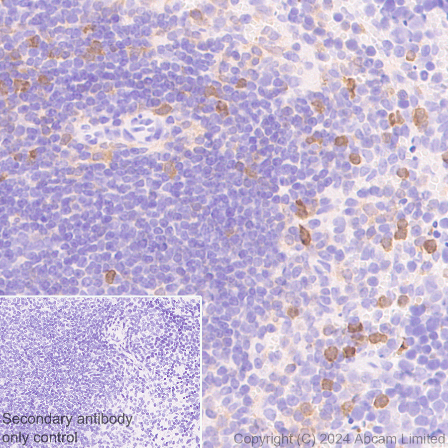 Immunohistochemistry (Formalin/PFA-fixed paraffin-embedded sections) - Anti-PADI2 / PAD2 antibody [EPR26940-85] (ab322197), expandable thumbnail