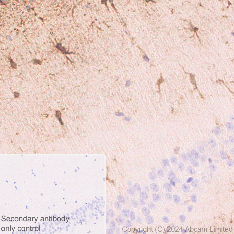 Immunohistochemistry (Formalin/PFA-fixed paraffin-embedded sections) - Anti-PADI2 / PAD2 antibody [EPR26940-85] (AB322197), expandable thumbnail