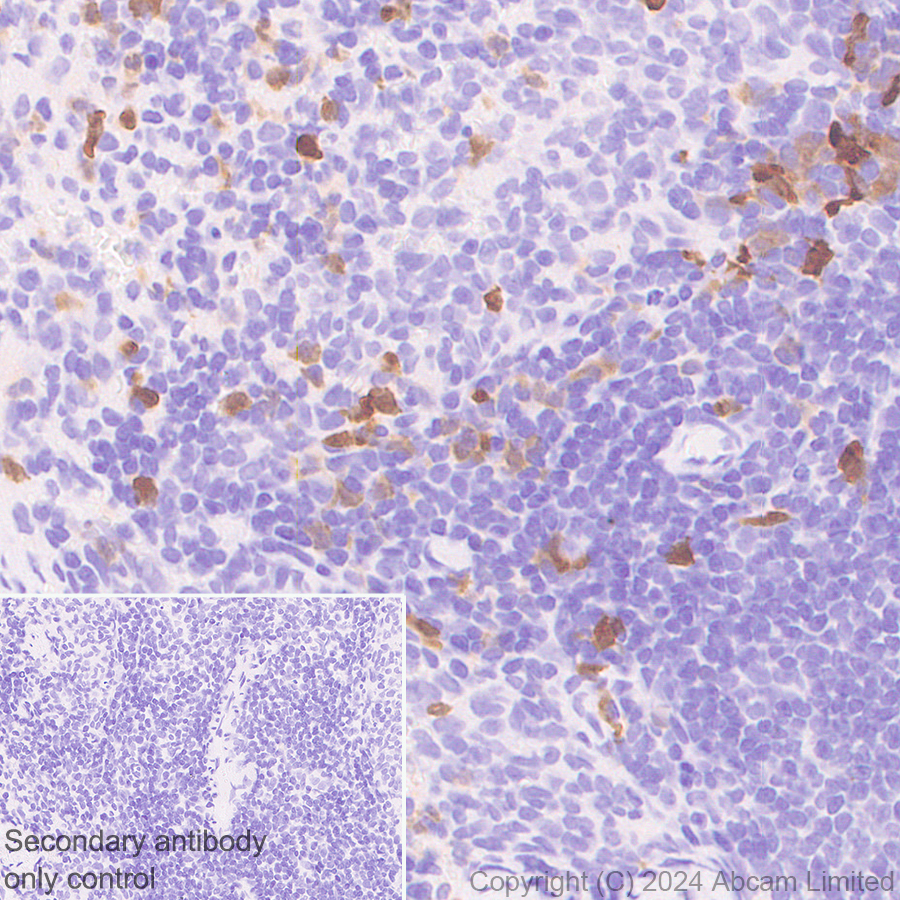 Immunohistochemistry (Formalin/PFA-fixed paraffin-embedded sections) - Anti-PADI2 / PAD2 antibody [EPR26940-85] (ab322197), expandable thumbnail