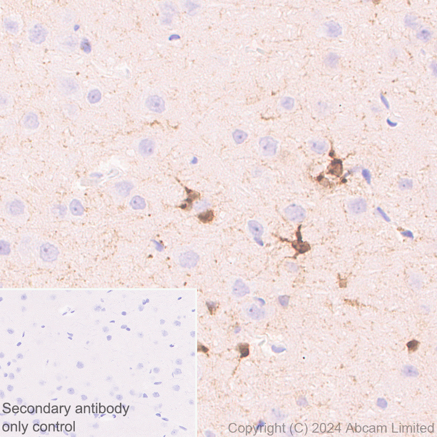 Immunohistochemistry (Formalin/PFA-fixed paraffin-embedded sections) - Anti-PADI2 / PAD2 antibody [EPR26940-85] (AB322197), expandable thumbnail