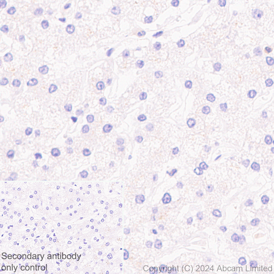 Immunohistochemistry (Formalin/PFA-fixed paraffin-embedded sections) - Anti-PADI2 / PAD2 antibody [EPR26940-85] (ab322197), expandable thumbnail