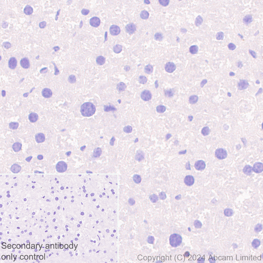 Immunohistochemistry (Formalin/PFA-fixed paraffin-embedded sections) - Anti-PADI2 / PAD2 antibody [EPR26940-85] (ab322197), expandable thumbnail