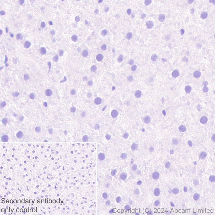 Immunohistochemistry (Formalin/PFA-fixed paraffin-embedded sections) - Anti-PADI2 / PAD2 antibody [EPR26940-85] (ab322197), expandable thumbnail