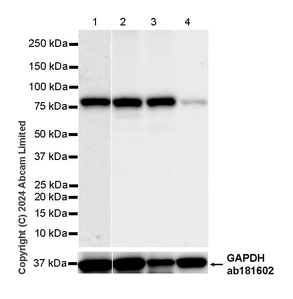 Western blot - Anti-PADI2 / PAD2 antibody [EPR26940-85] (AB322197), expandable thumbnail
