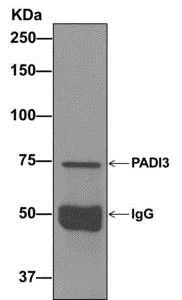 Immunoprecipitation - Anti-PADI3 / PAD3 antibody [EPR12165(B)] (AB172959)