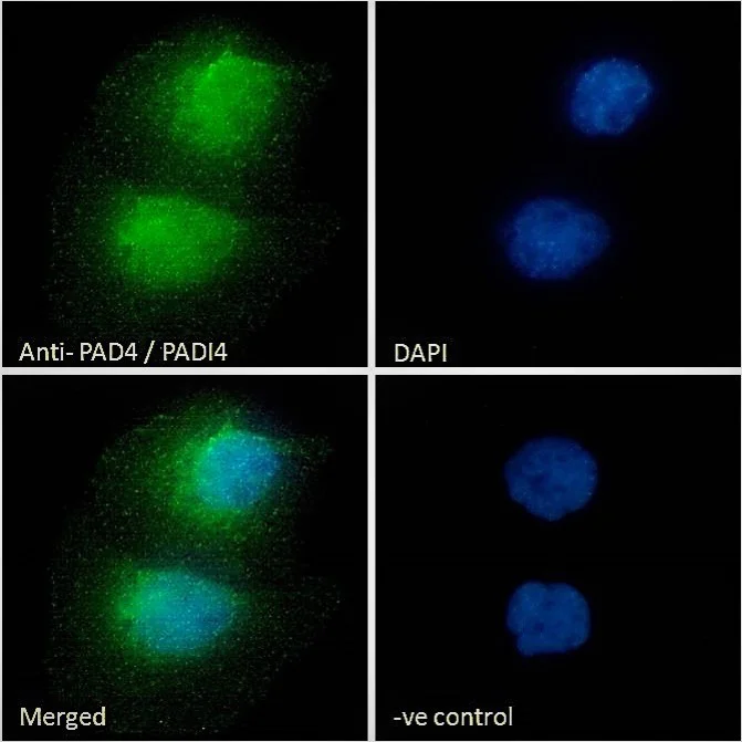Immunocytochemistry - Anti-PADI4 / PAD4 antibody (AB26071)