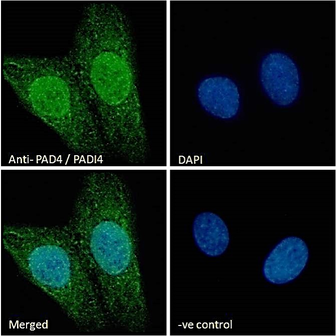 Immunocytochemistry - Anti-PADI4 / PAD4 antibody (AB26071)