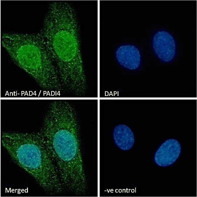 Immunocytochemistry - Anti-PADI4 / PAD4 antibody (AB26071)