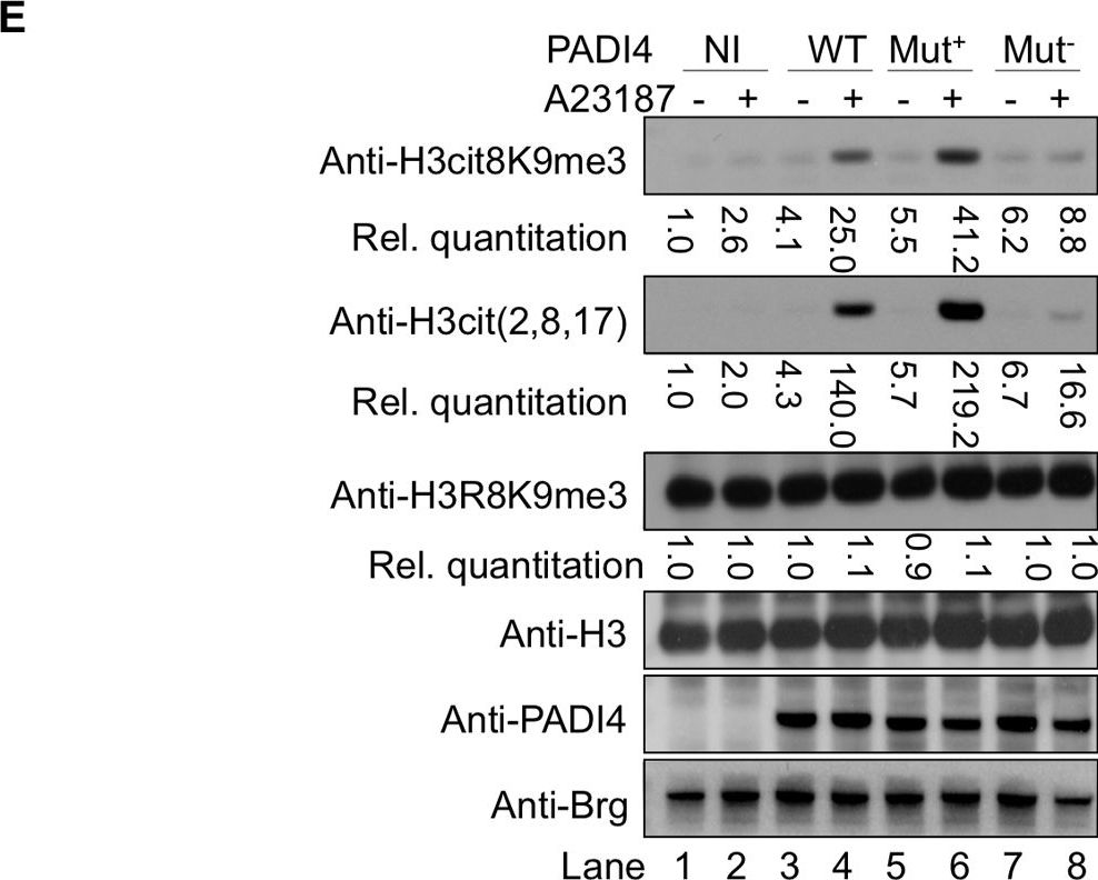 Western blot - Anti-PADI4 / PAD4 antibody (AB50332)