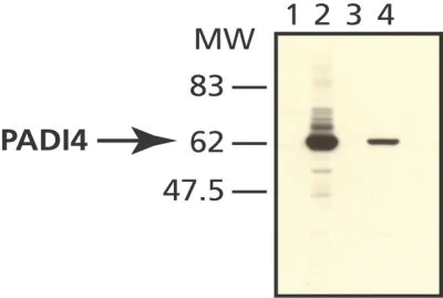 Western blot - Anti-PADI4 / PAD4 antibody (AB50332)