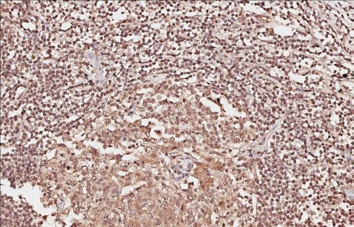 Immunohistochemistry (Formalin/PFA-fixed paraffin-embedded sections) - Anti-PADI4 / PAD4 antibody (AB96758)
