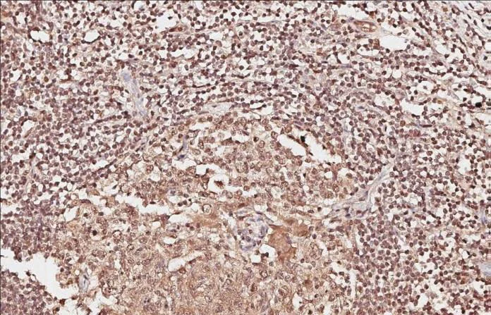 Immunohistochemistry (Formalin/PFA-fixed paraffin-embedded sections) - Anti-PADI4 / PAD4 antibody (AB96758)