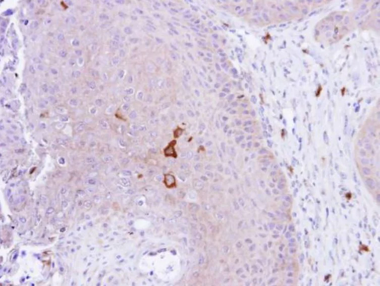 Immunohistochemistry (Formalin/PFA-fixed paraffin-embedded sections) - Anti-PADI4 / PAD4 antibody (AB96758)