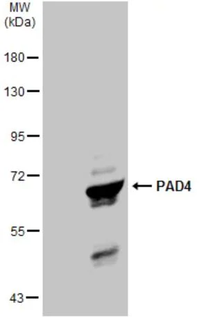 Western blot - Anti-PADI4 / PAD4 antibody (AB96758)