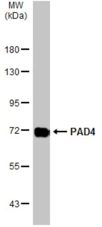 Western blot - Anti-PADI4 / PAD4 antibody (AB96758)
