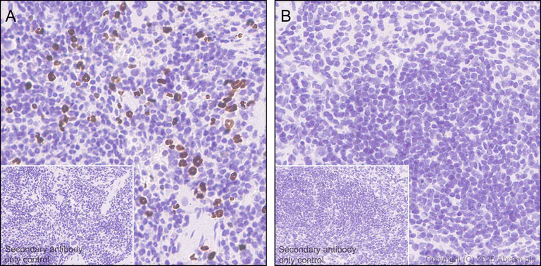 Immunohistochemistry (Formalin/PFA-fixed paraffin-embedded sections) - Anti-PADI4 / PAD4 antibody [EPR20706] (AB214810)