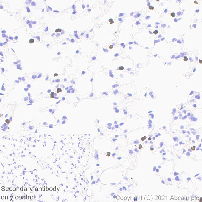 Immunohistochemistry (Formalin/PFA-fixed paraffin-embedded sections) - Anti-PADI4 / PAD4 antibody [EPR20706] (AB214810)