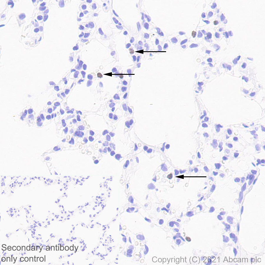 Immunohistochemistry (Formalin/PFA-fixed paraffin-embedded sections) - Anti-PADI4 / PAD4 antibody [EPR20706] (AB214810)