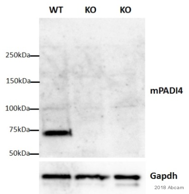 Anti-PADI4 / PAD4 antibody [EPR20706]