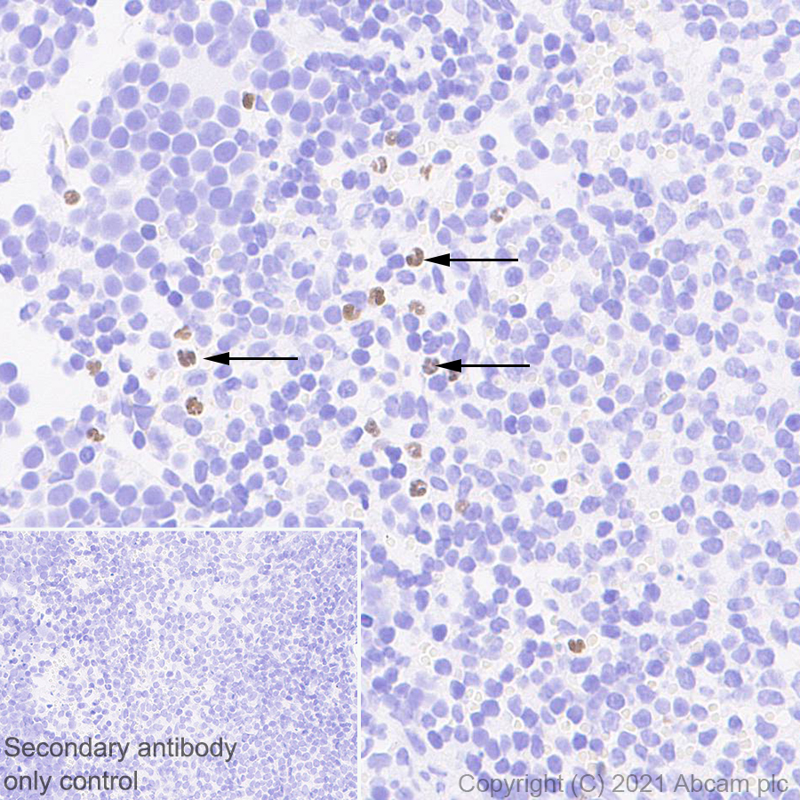 Immunohistochemistry (Formalin/PFA-fixed paraffin-embedded sections) - Anti-PADI4 / PAD4 antibody [EPR20706] - BSA and Azide free (AB227891), expandable thumbnail