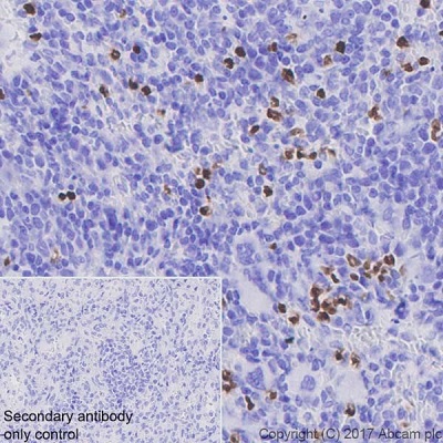 Immunohistochemistry (Formalin/PFA-fixed paraffin-embedded sections) - Anti-PADI4 / PAD4 antibody [EPR20706] - BSA and Azide free (AB227891), expandable thumbnail