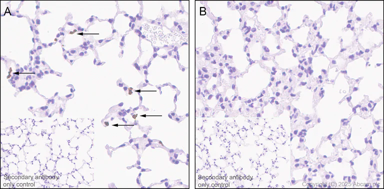 Immunohistochemistry (Formalin/PFA-fixed paraffin-embedded sections) - Anti-PADI4 / PAD4 antibody [EPR20706] - BSA and Azide free (AB227891)