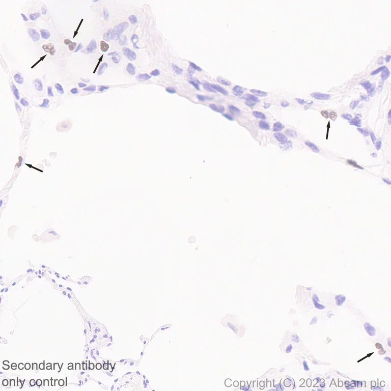 Immunohistochemistry (Formalin/PFA-fixed paraffin-embedded sections) - Anti-PADI4 / PAD4 antibody [EPR26687-49] (AB315269)