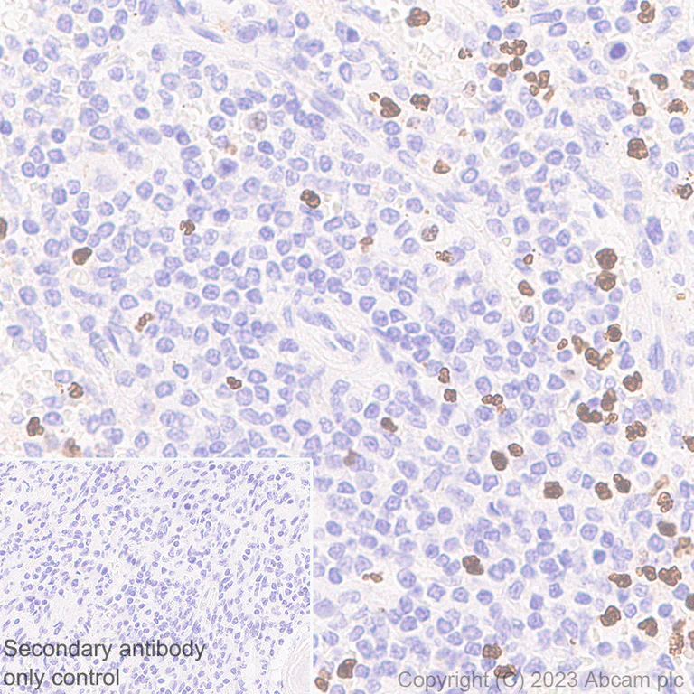 Immunohistochemistry (Formalin/PFA-fixed paraffin-embedded sections) - Anti-PADI4 / PAD4 antibody [EPR26687-49] - BSA and Azide free (AB315270)