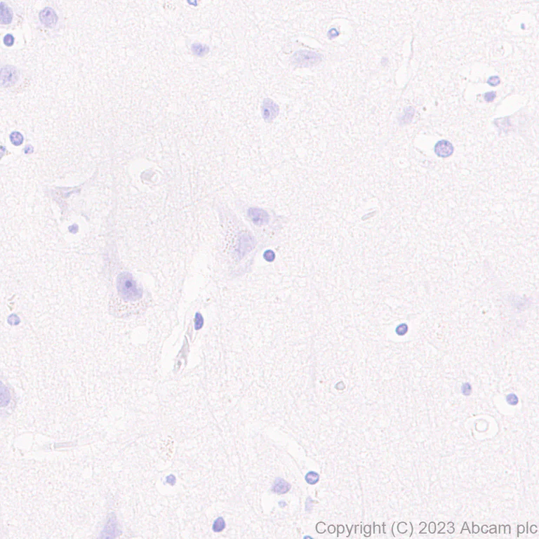 Immunohistochemistry (Formalin/PFA-fixed paraffin-embedded sections) - Anti-PADI4 / PAD4 antibody [EPR26687-49] - BSA and Azide free (AB315270)
