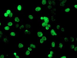 Immunocytochemistry/ Immunofluorescence - Anti-PADI4 / PAD4 antibody [OTI4H5] (AB128086), expandable thumbnail