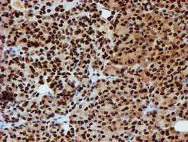 Immunohistochemistry (Formalin/PFA-fixed paraffin-embedded sections) - Anti-PADI4 / PAD4 antibody [OTI4H5] (ab128086), expandable thumbnail
