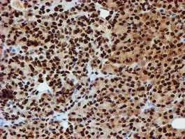 Immunohistochemistry (Formalin/PFA-fixed paraffin-embedded sections) - Anti-PADI4 / PAD4 antibody [OTI4H5] (AB128086)