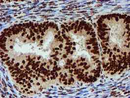 Immunohistochemistry (Formalin/PFA-fixed paraffin-embedded sections) - Anti-PADI4 / PAD4 antibody [OTI4H5] (ab128086), expandable thumbnail