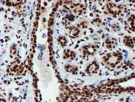 Immunohistochemistry (Formalin/PFA-fixed paraffin-embedded sections) - Anti-PADI4 / PAD4 antibody [OTI4H5] (AB128086), expandable thumbnail