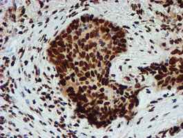 Immunohistochemistry (Formalin/PFA-fixed paraffin-embedded sections) - Anti-PADI4 / PAD4 antibody [OTI4H5] (AB128086), expandable thumbnail