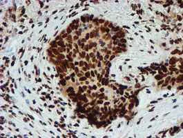 Immunohistochemistry (Formalin/PFA-fixed paraffin-embedded sections) - Anti-PADI4 / PAD4 antibody [OTI4H5] (AB128086)