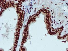Immunohistochemistry (Formalin/PFA-fixed paraffin-embedded sections) - Anti-PADI4 / PAD4 antibody [OTI4H5] (ab128086), expandable thumbnail