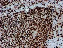 Immunohistochemistry (Formalin/PFA-fixed paraffin-embedded sections) - Anti-PADI4 / PAD4 antibody [OTI4H5] (ab128086), expandable thumbnail